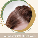 What's PCOS Hair Loss?